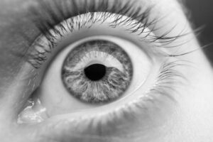Optophobia fear of opening eyes